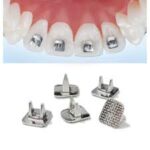 Tongue Spurs /Tammers - 10pcs/pack
