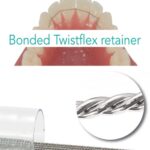 Lingual Retainer Twistflex Wire 1pcs-USA