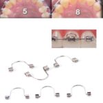 Torque Spring Medium -  5Pcs/pack